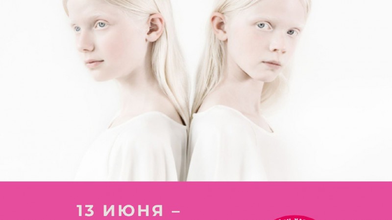 13 июня – Международный день распространения информации об альбинизме