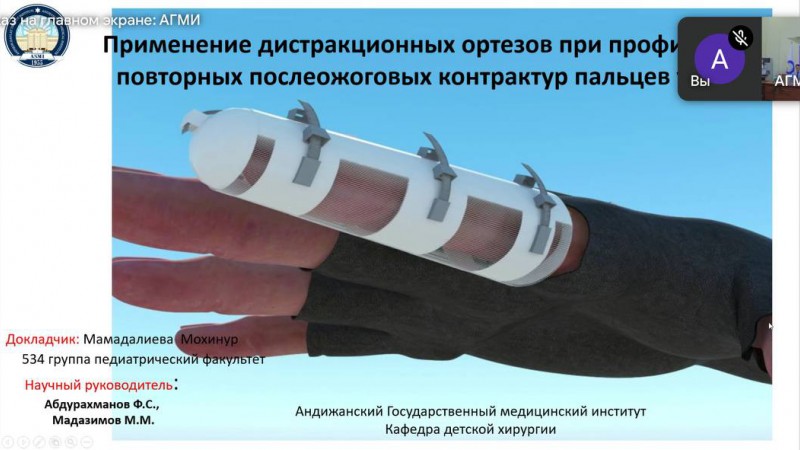 На базе ГрГМУ прошел I международный научно-практический онлайн-семинар по детской хирургии «Молодёжная наука ГрГМУ-АГМИ – 2024»