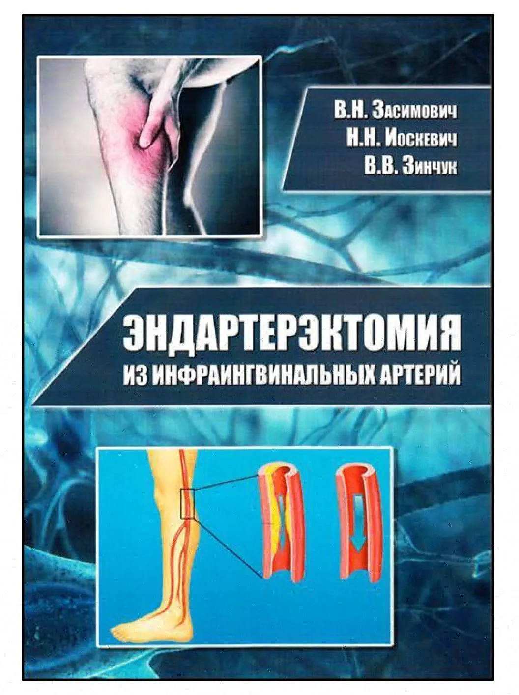 Издана монография в кооперации с клиницистами