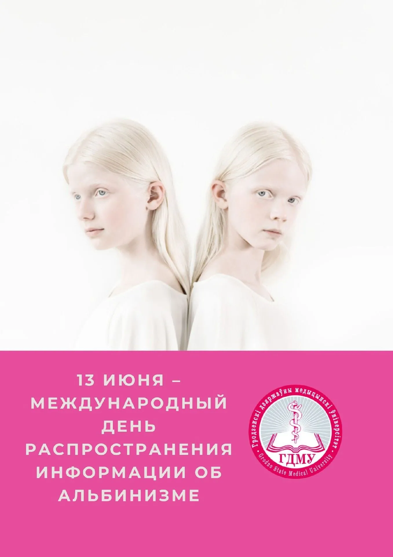 13 июня – Международный день распространения информации об альбинизме