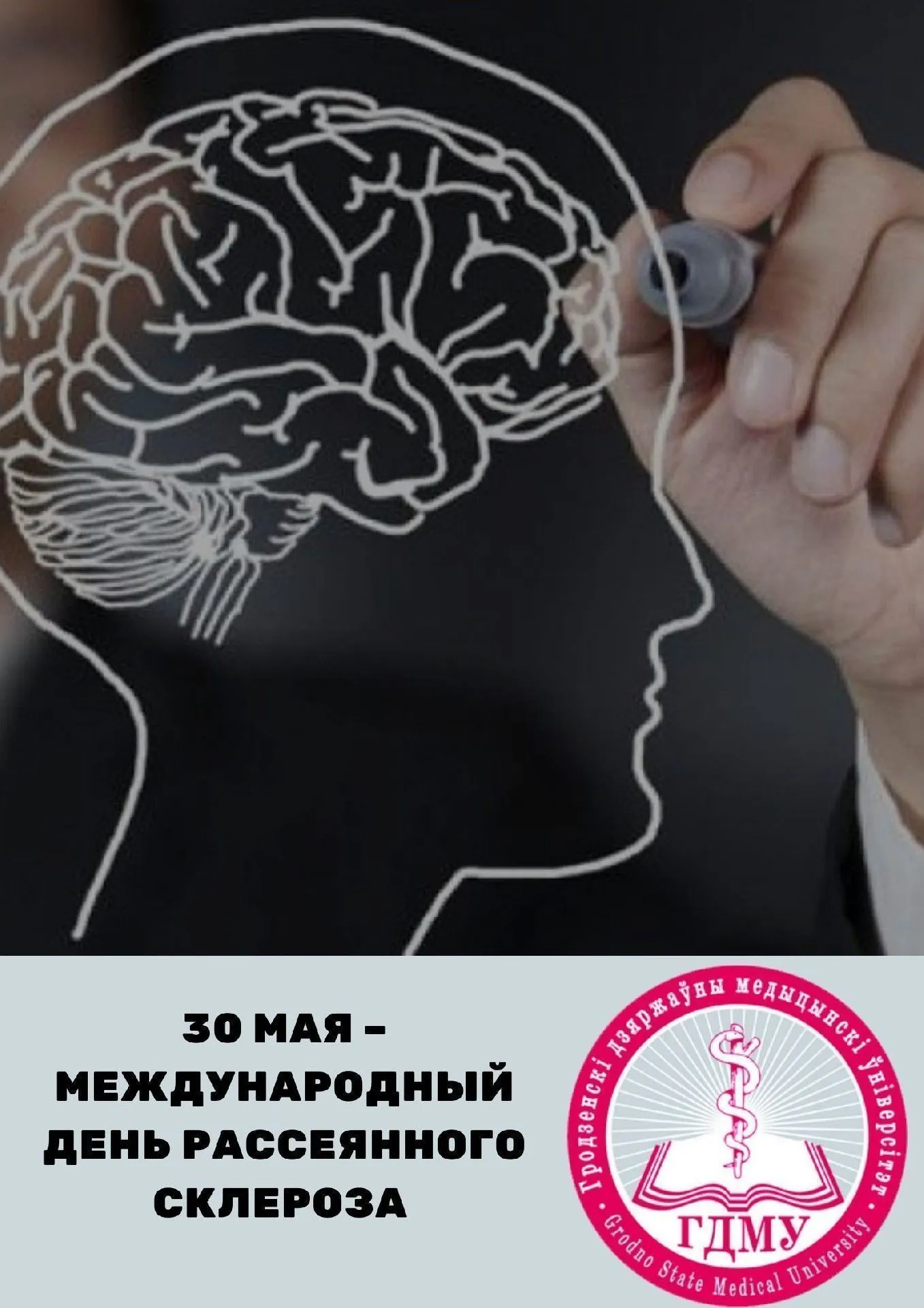 Международный День рассеянного склероза (МДРС)