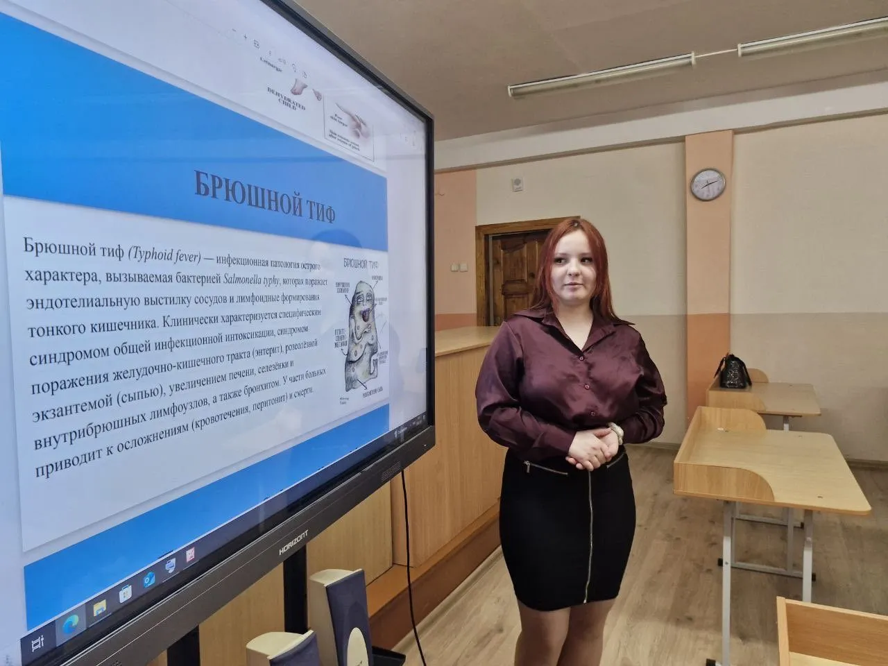 Кишечные инфекции