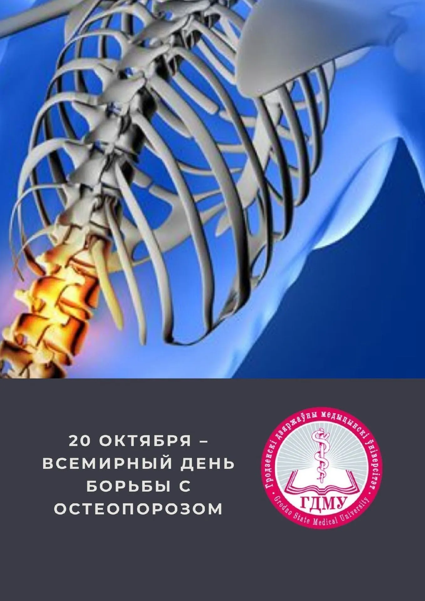 Всемирный день борьбы с остеопорозом
