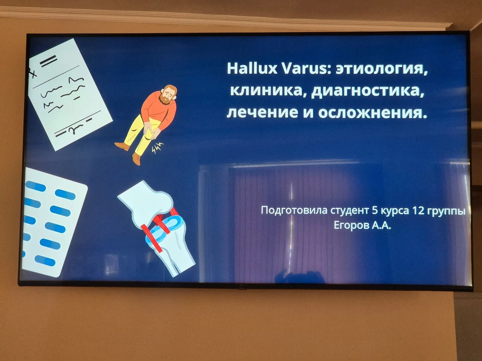На кафедре травматологии, ортопедии и ВПХ прошло заседание студенческого научного кружка, посвящённое хирургии стопы