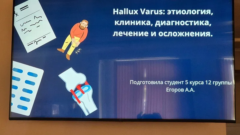На кафедре травматологии, ортопедии и ВПХ прошло заседание студенческого научного кружка, посвящённое хирургии стопы